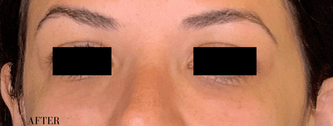 After Image