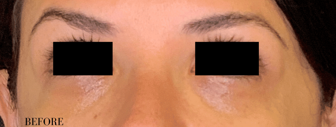 Before Image