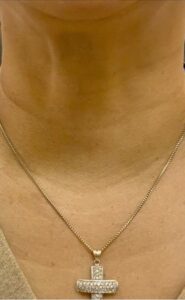 Before Image: Xeomin