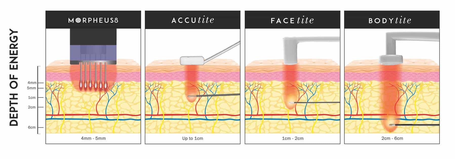 AccuTite in Upper East Side & NYC 2 picture2