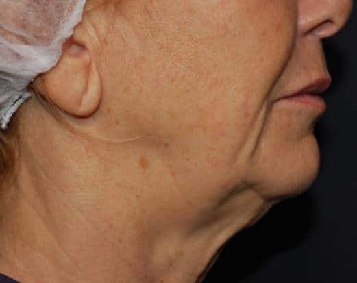 Facetite in Upper East Side & NYC 7 picture8